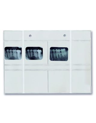 Röntgen-Klarsichttaschen zfv 3x4cm - 100St.