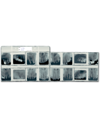 Spitta Röntgen-Sammeltasche für 16 Aufnahmen 4x5 cm - 100 Stk.